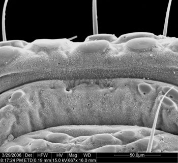Media type: image;   Invertebrate Zoology 133769